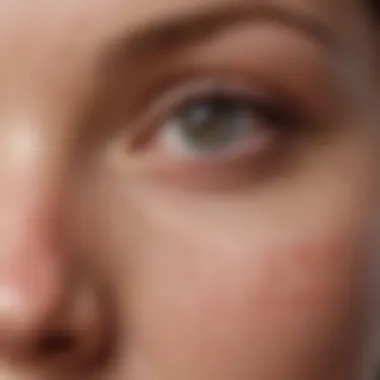 Close-up of eczema-affected skin around the eyes